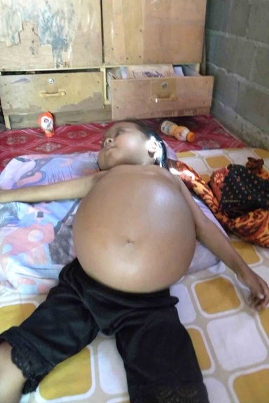 Nur Atiqah hanya bisa berbaring
