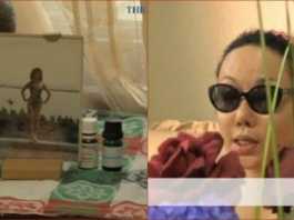 mantan-miss-korea-ini-kehilangan-setengah-payudara-akibat-oplas-20141107065737