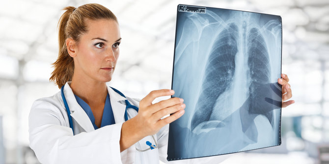 5-hal-yang-meningkatkan-risiko-kanker-paru-paru