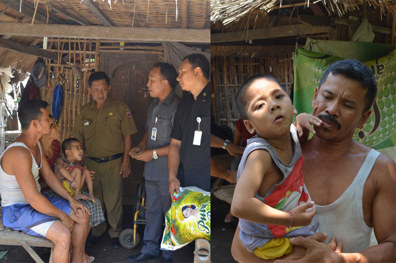 Ketebatasan Biaya, Bocah Penderita Meningitis Bakteri di Bali Hanya Dirawat di Rumah