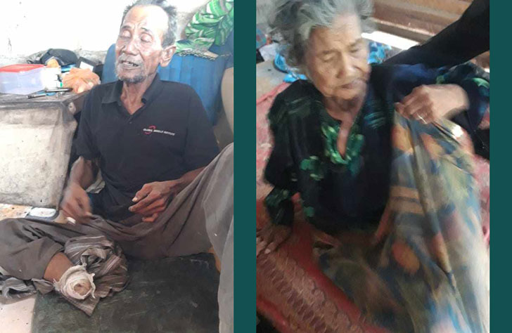 Seorang Warga Miskin Di Sawang Kuba, Potong Kakinya Sendiri Akibat Luka Tak Kunjung Sembuh