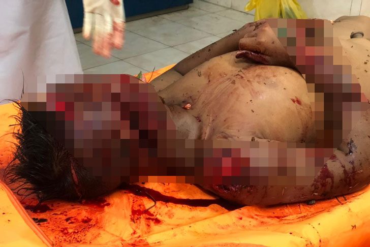 Mayat-Bocah-penuh-sabitan-Parang