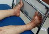 Tubuh Korban dipenuhi dengan darah