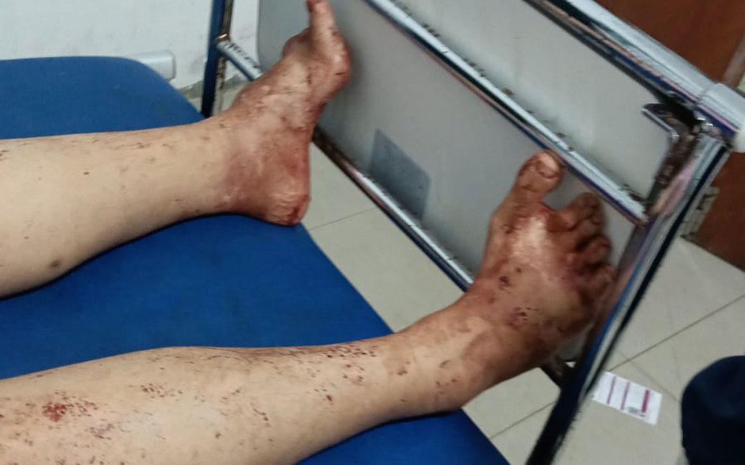 Terjadi Perampokan Di Jalan M Yani Tanjungbatu, Seorang Wanita Mengalami Luka Tusuk Terjadi Perampokan Di Jalan M Yani Tanjungbatu, Seorang Wanita Mengalami Luka Tusuk