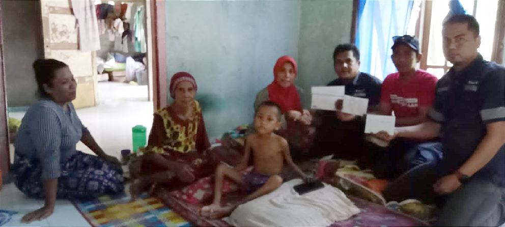 Karyawan PT Timah Tbk Galang Donasi untuk Anggun, Bocah Penderita Getah Bening